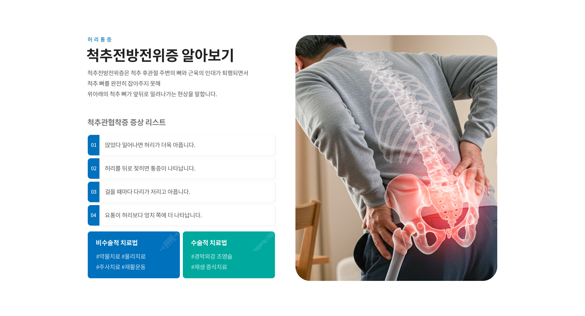 척추전방전위증